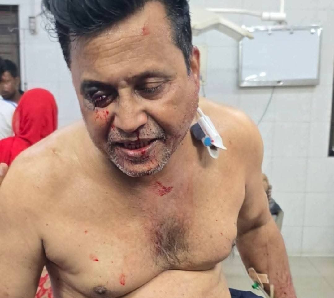 কুষ্টিয়ার মিরপুরে সাবেক আওয়ামী লীগের সাধারণ সম্পাদক কে গুলি করে হত্যার চেষ্টা